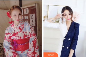 珠?；輴?ài)醫(yī)院整形美容科于燕整形價(jià)格表附紅藍(lán)光去痘案例展示