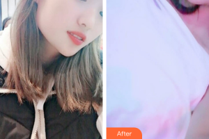 珠海拜博口腔醫(yī)院徐連來整形價(jià)格表附超聲波洗牙案例展示