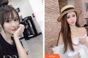 佛山華美整形美容醫(yī)院梁宗建整形價格表附鼻部手術(shù)案例展示