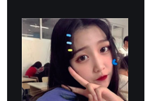 武漢東南醫(yī)院整形美容科尹超整形價(jià)格表附無針?biāo)獍咐故?>
</a>
<h3 class=