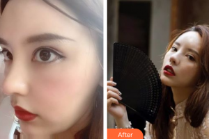 佛山醫(yī)博士醫(yī)療美容門診部林茂輝整形價(jià)格表附超微小氣泡案例展示