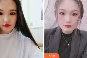 佛山美嘉美醫(yī)療美容門診部徐麗心整形價(jià)格表附白瓷娃娃案例展示