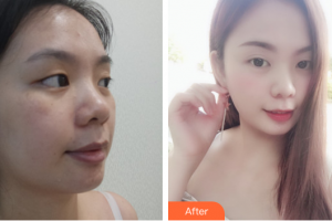 湛江市第一中醫(yī)院整形美容中心萬(wàn)敏整形價(jià)格表附無(wú)針?biāo)獍咐故?>
</a>
<h3 class=