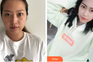 東莞市人民醫(yī)院醫(yī)學(xué)美容科陳曉武整形價格表附祛斑祛痣案例展示