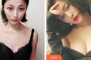 東莞百佳瑪麗亞婦產(chǎn)醫(yī)院李昌煥整形價格表附假體隆胸案例展示