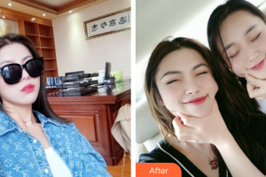 東莞韓美整形醫(yī)院樸正淳整形價格表附水光補水案例展示