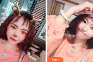 東莞瑞芙臣醫(yī)療美容門診部ColetteC整形價格表附超微小氣泡案例展示