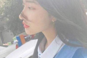 沈陽盛京尚美醫(yī)療美容診所管連斌整形價格表附假體隆鼻案例展示