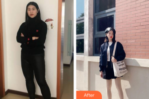 東莞華美醫(yī)療美容醫(yī)院劉潤(rùn)貴整形價(jià)格表附吸脂案例展示