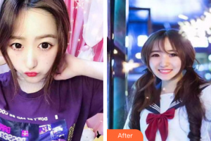 東莞百佳瑪麗亞婦產(chǎn)醫(yī)院馮艷萍整形價(jià)格表附果酸換膚案例展示