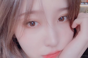 武漢華亞美容醫(yī)院張思雄整形價格表附清潔祛痘案例展示