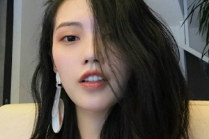 武漢美基元醫(yī)療美容醫(yī)院盛敏蘭整形價格表附激光祛斑案例展示