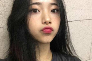 武漢科技大學(xué)附屬天佑醫(yī)院整形美容科李蕓整形價格表附去痘印痘坑案例展示