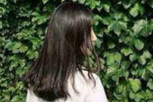 長(zhǎng)春醫(yī)美整形美容醫(yī)院樸原辰整形價(jià)格表附埋線提升案例展示