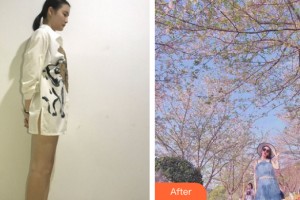 河南整形美容醫(yī)院安一峰整形價格表附大腿吸脂案例展示