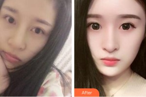 河南省軍區(qū)醫(yī)院激光美容中心姬瑜   整形價格表附皮膚美容案例展示