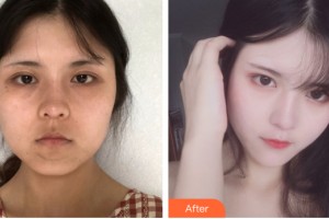 河南省整形美容研究中心李媛整形價(jià)格表附皮膚美容案例展示