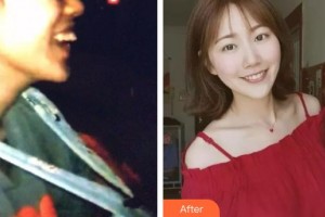 湖北恩施咿呀牙科診所丁小璐整形價格表附隱形托槽矯正案例展示