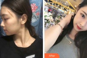 海南整形美容醫(yī)院馬文熙教授，整形價(jià)格表附皮膚美容案例展示