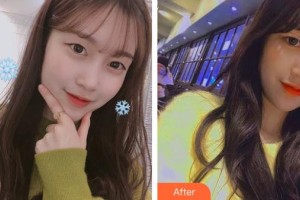 云南華美美萊美容醫(yī)院楊繼紅整形價(jià)格表附埋線雙眼皮案例展示