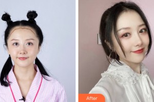 海南夢妮幻整形?？崎T診部費(fèi)艷麗整形價(jià)格表附植發(fā)案例展示