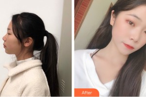 海南夢妮幻整形?？崎T診部史雅丹主診醫(yī)師整形價(jià)格表附皮膚美容案例展示