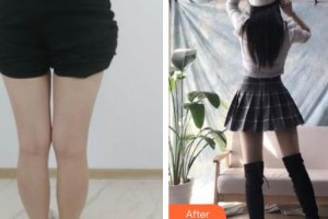 云南華美美萊美容醫(yī)院黃麗瓊整形價格表附吸脂案例展示