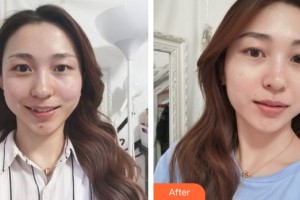 海南省皮膚病醫(yī)院激光整形美容中心段爭(zhēng)躍整形價(jià)格表附皮膚美容案例展示