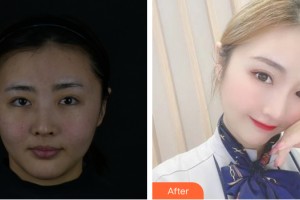 海南純美醫(yī)療整形門診部孫桂福整形價(jià)格表附皮膚美容案例展示