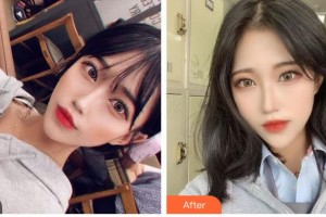 昆明吳氏嘉美美容醫(yī)院莊蔚強(qiáng)整形價格表附鼻部綜合案例展示