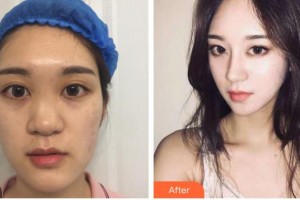 昆明麗都醫(yī)療美容醫(yī)院姜海燕整形價格表附鼻部綜合案例展示