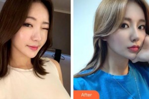 昆明前衛(wèi)美眼整形?？圃\所馮曉明整形價格表附鼻部綜合案例展示