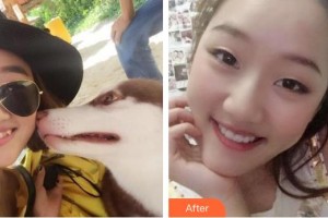 昆明薇莎整形美容醫(yī)院潘先勇整形價(jià)格表附牙齒隱形矯正案例展示