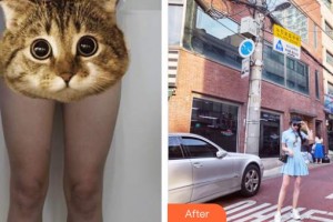 昆明都市儷人美容醫(yī)院葉根生整形價(jià)格表附吸脂案例展示