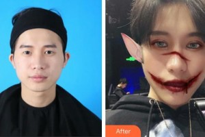 昆明美立方（原大華）醫(yī)療美容醫(yī)院辛杰整形價(jià)格表附眼部綜合案例展示