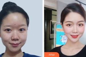 昆明皮膚病?？漆t(yī)院黃文標(biāo)整形價(jià)格表附激光祛斑案例展示