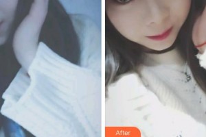 昆明皮膚病?？漆t(yī)院王正文整形價格表附眼部綜合案例展示