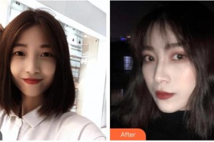 昆明愛爾眼科醫(yī)院孫鵬整形價格表附眼部綜合案例展示