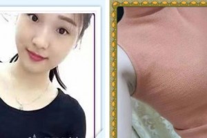 揚州施爾美醫(yī)療美容醫(yī)院冷永成整形價格表附自體脂肪隆胸案例展示