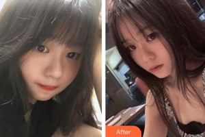 昆明康特森眼科醫(yī)院王慧整形價(jià)格表附眼部綜合案例展示