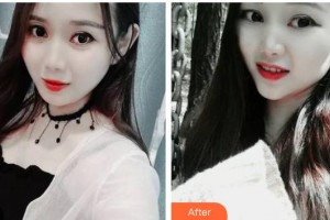 昆明拜博口腔醫(yī)院劉春雷整形價(jià)格表附牙齒隱形矯正案例展示