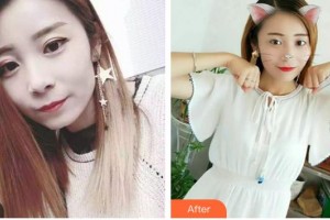 昆明愛雅仕口腔醫(yī)院晁瑜蔓整形價格表附牙齒隱形矯正案例展示