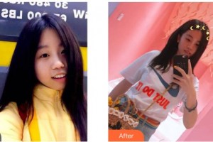 昆明醫(yī)科大學(xué)附屬口腔醫(yī)院億大口腔門診部楊雁整形價格表附冷光美白案例展示