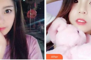 昆明醫(yī)科大學(xué)附屬口腔醫(yī)院億大口腔門(mén)診部華文整形價(jià)格表附牙齒隱形矯正案例展示