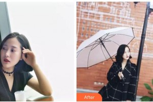 昆明醫(yī)科大學(xué)附屬口腔醫(yī)院億大口腔門診部楊希整形價(jià)格表附超聲波潔牙案例展示