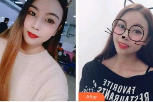 昆明拜博口腔醫(yī)院江忠蔓整形價(jià)格表附牙貼面案例展示