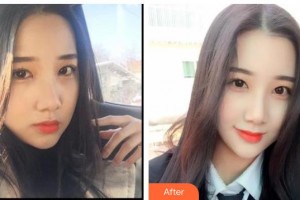 曲靖口腔醫(yī)院賴本龍整形價格表附冷光美白案例展示