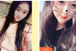 曲靖韓美醫(yī)療美容門診部（原靖美）呂朋梟整形價(jià)格表附金屬托槽矯正案例展示