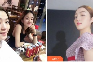 昭通瑪麗婦產(chǎn)醫(yī)院整形美容科韓受亨整形價(jià)格表附隆鼻案例展示