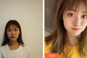 武漢華中科技大學(xué)同濟(jì)醫(yī)學(xué)院醫(yī)院整形美容醫(yī)院黃巖整形價格表附眼部手術(shù)案例展示